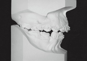 Case photo, side view, right