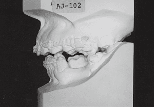 Case photo: Side view, front