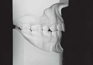 Case photo, side view, right