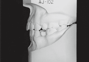 Case photo: Side view, front