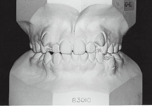 Case photo: Side view, front