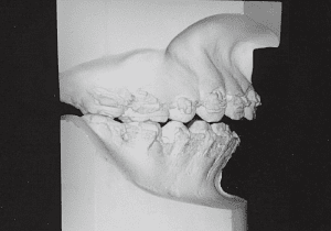 Case photo, side view, right
