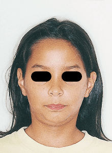 Case photo: Side view, front