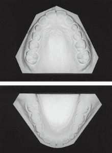 Case photo: Side view, front