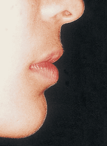 Case photo, side view, right