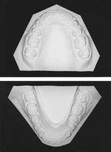 Case photo: Side view, front