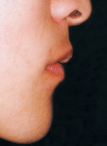 Case photo, side view, right