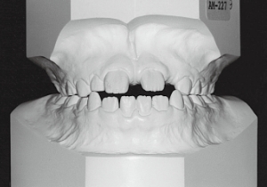 Case photo: Side view, front