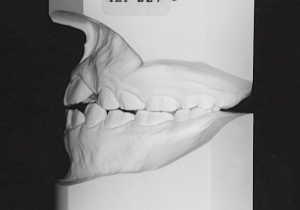 Case photo, side view, left