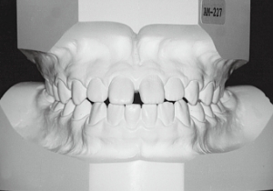 Case photo: Side view, front