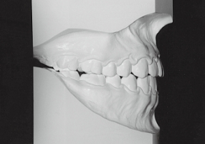 Case photo, side view, right