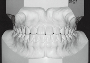 Case photo: Side view, front