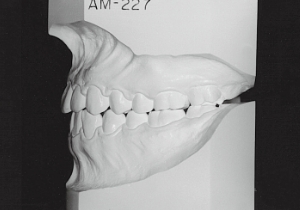 Case photo, side view, left