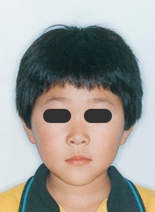 Case photo: Side view, front