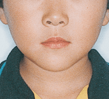 Case photo: Side view, front