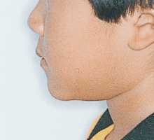 Case photo, side view, left