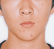 Case photo: Side view, front