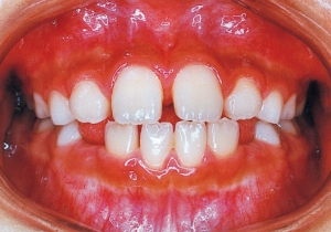 Case photo: Side view, front