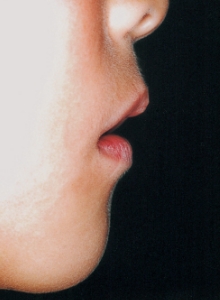 Case photo, side view, right