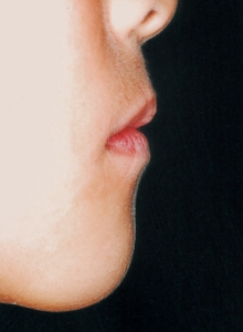 Case photo: Side view, front