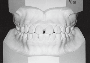 Case photo: Side view, front