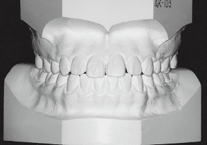 Case photo: Side view, front