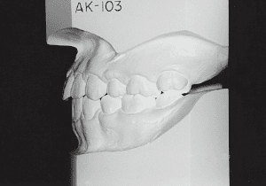 Case photo, side view, left