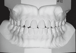 Case photo: Side view, front