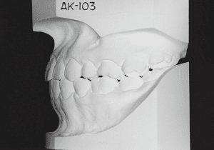 Case photo, side view, left