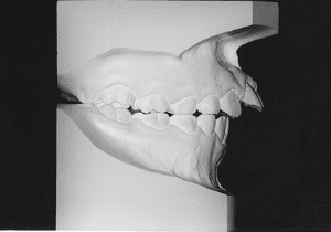 Case photo, side view, right