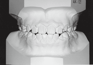 Case photo: Side view, front