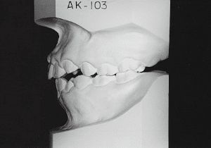 Case photo, side view, left