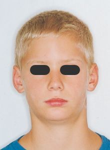 Case photo: Side view, front