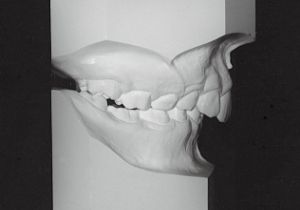 Case photo, side view, right