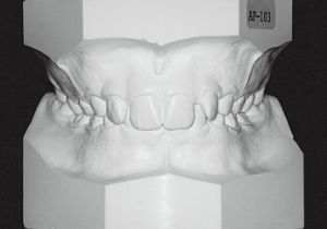 Case photo: Side view, front