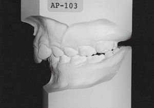 Case photo, side view, left