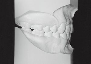 Case photo, side view, right