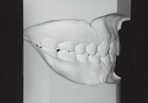 Case photo, side view, right