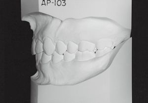 Case photo, side view, left