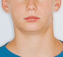 Case photo: Side view, front