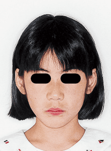 Case photo: Side view, front