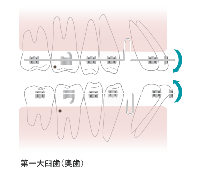 スタンダードエッジワイズ法（ワイヤー矯正）の仕組み - Yogosawa